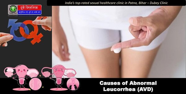 Abnormal Leucorrhoea Causes
