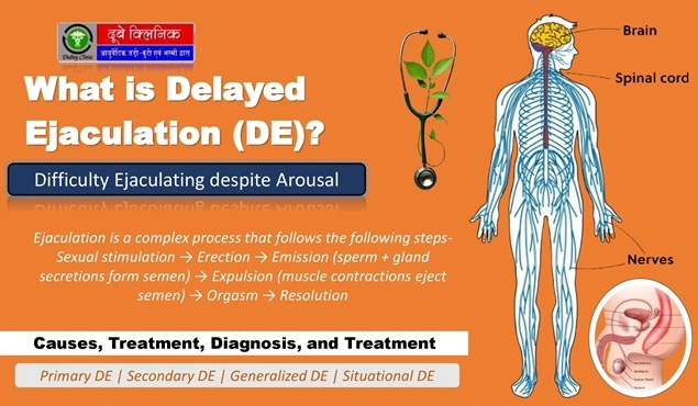 Delayed Ejaculation Treatment