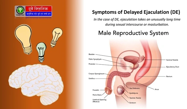 Delayed Ejaculation Treatment