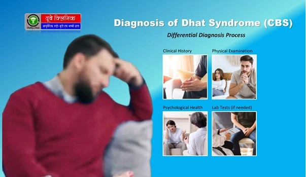  Dhat Syndrome Treatment
