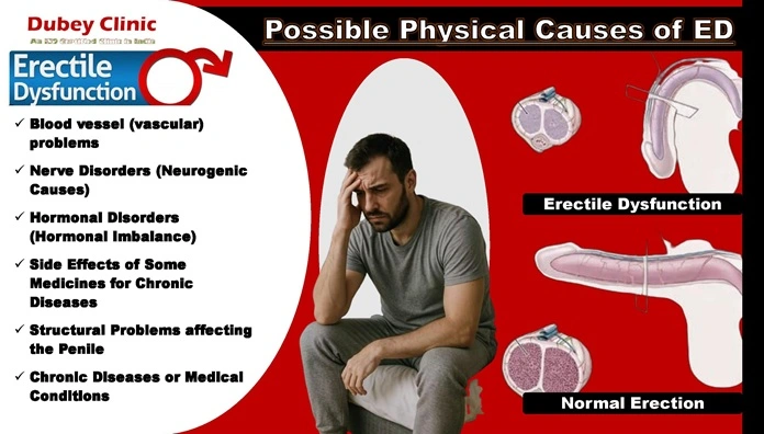 erectile-dsyfunction-treatment