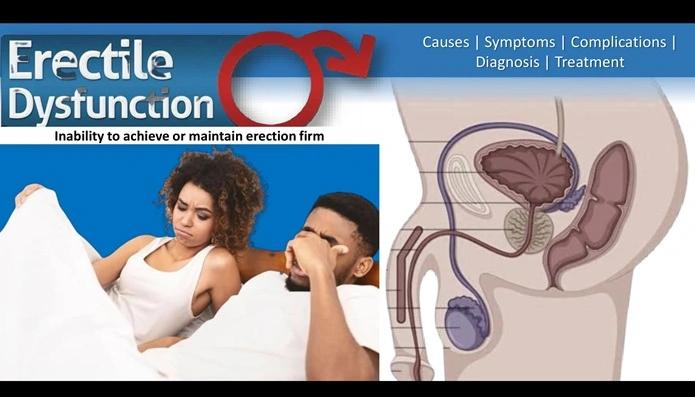erectile-dsyfunction-treatment