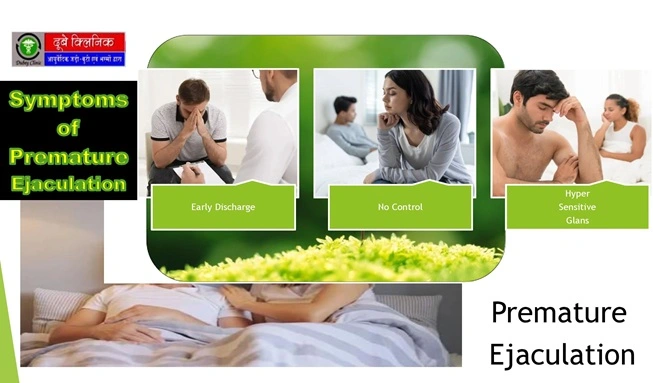 male-premature-ejaculation-treatment