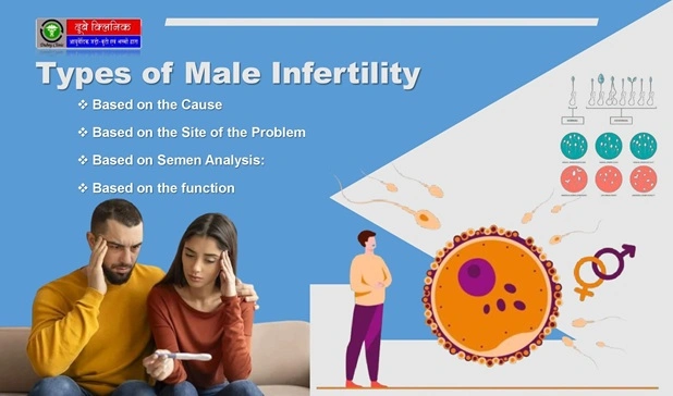 Male Infertlity Treatment