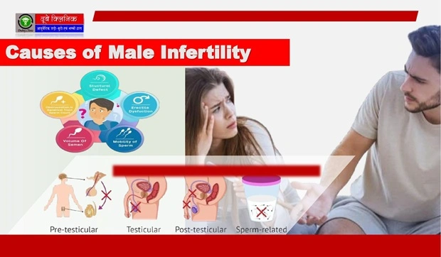 Male Infertlity Treatment